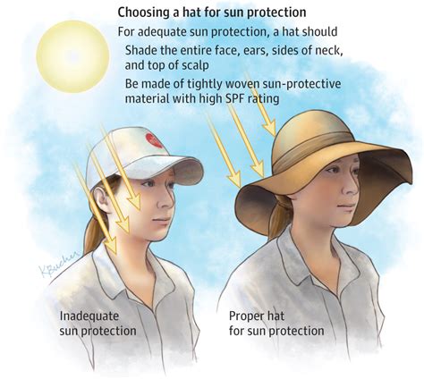 difference between suntan and sunburn.